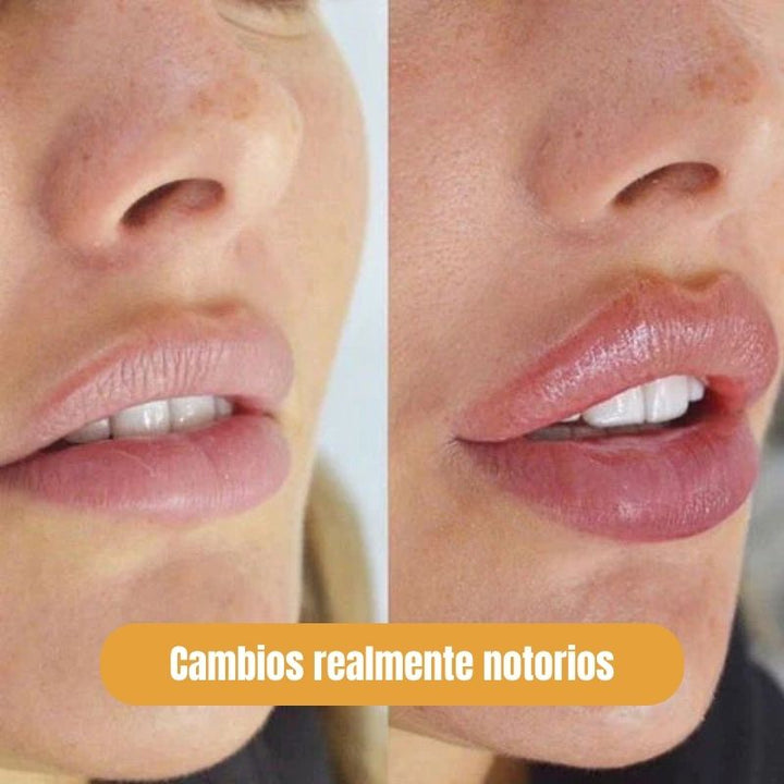 Kiss Beauty® Premiado Como El Mas Efectivo 2x1
